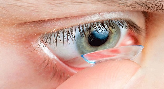 Scleral Lens